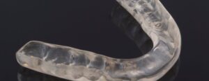 clinica_dental_oroa_ferula_bruxismo