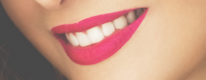 Clínica dental OROA_Blanqueamiento dental con implantes